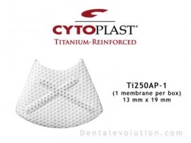 Ti-250 Anterior Perio (1 membrane per box)